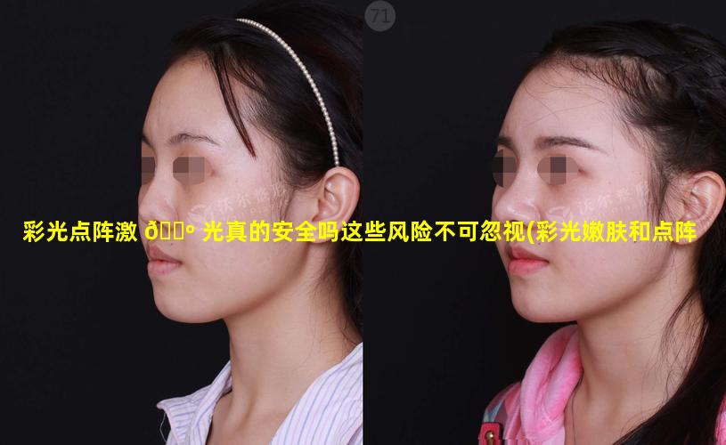 彩光点阵激 🐺 光真的安全吗这些风险不可忽视(彩光嫩肤和点阵激光哪个收缩 🍁 毛孔效果好)